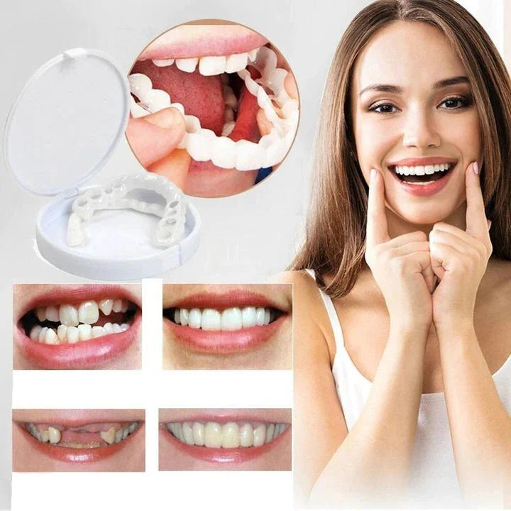 Custom Fit Snap On Cosmetic Teeth Veneers