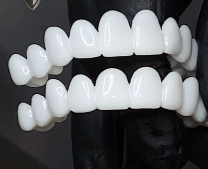 Custom Fit Cosmetic Snap On Smile Veneers