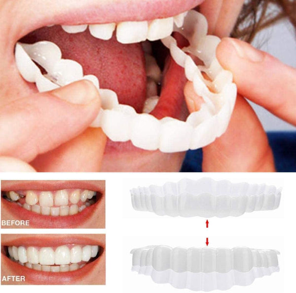 Custom Fit Smile Veneers Upper Lower Teeth Covers