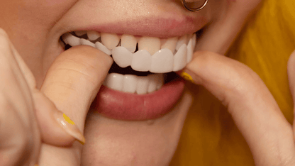 Custom Fit Snap On Cosmetic Teeth Veneers