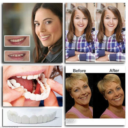 Custom Fit Snap On Smile Teeth Veneers
