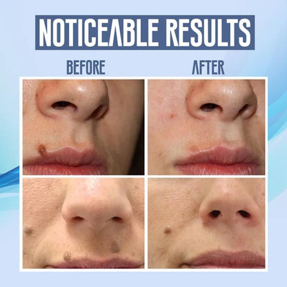 Facial Hair Removal Pen Rechargeable Precision Trimmer