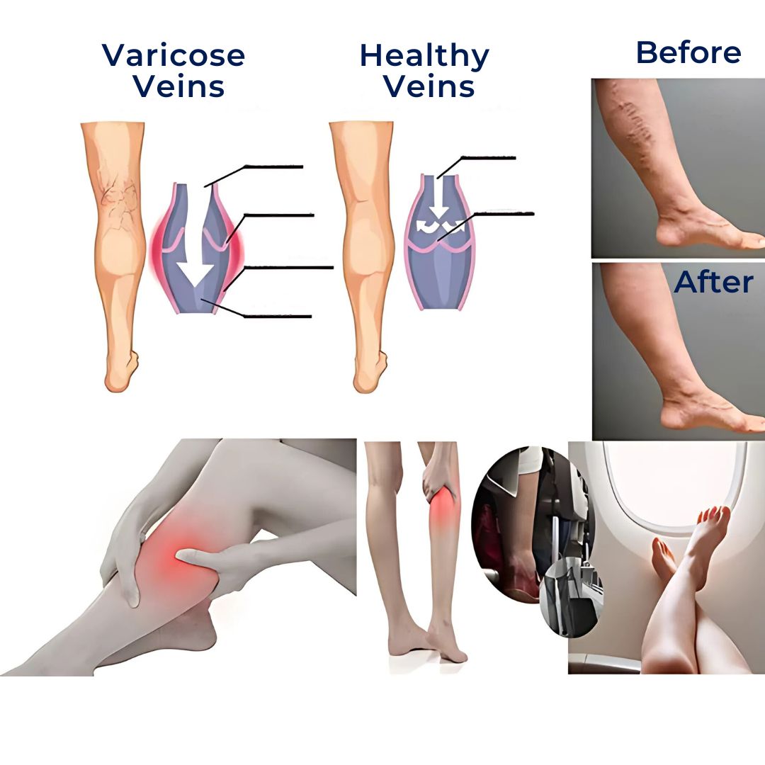Graduated Compression Calf Support Socks for Everyday Comfort