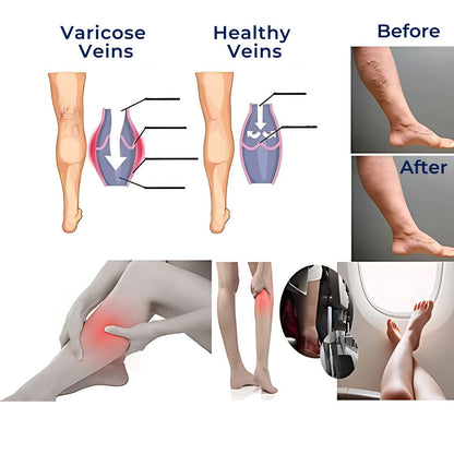 Graduated Compression Calf Support Socks for Everyday Comfort