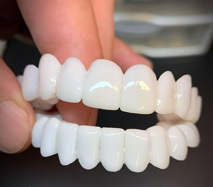 Natural Fit Dental Veneers Comfortable Reusable Smile Cover