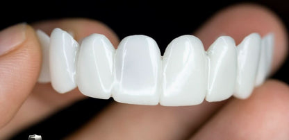 Reusable Natural Look Denture Teeth Set