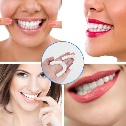 Temporary Snap On Dental Veneer for Cosmetic Smile Enhancement