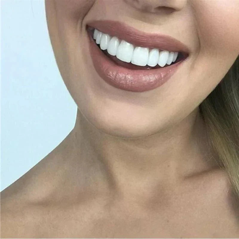 Temporary Snap On Dental Veneer for Cosmetic Smile Enhancement
