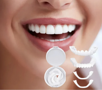 Temporary Snap On Dental Veneer for Cosmetic Smile Enhancement