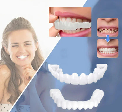 Temporary Snap On Dental Veneer for Cosmetic Smile Enhancement