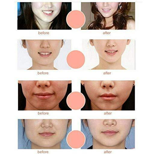 V Shape Chin Lift Face Support Mask
